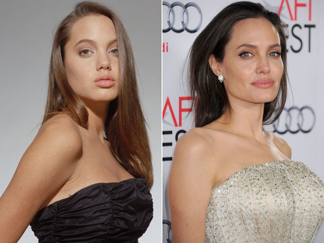 angelina-jolie-plastic-surgery-1.jpg