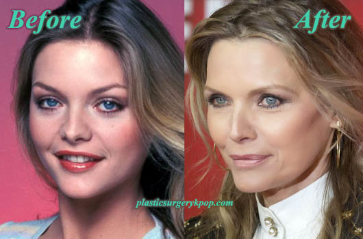 MichellePfeifferPlasticSurgeryNoseJob.jpg