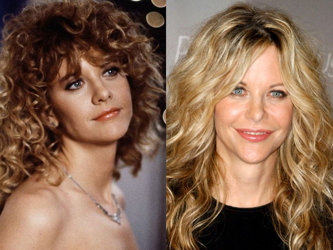 Meg_Ryan_after_plastic_surgery.jpg