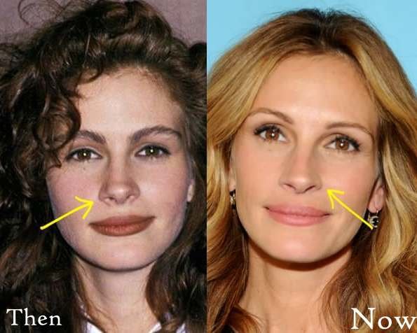 Julia-Roberts-Before-And-After-Pictures.jpg