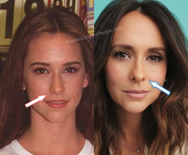 jennifer-love-hewitt-nose-job.jpg